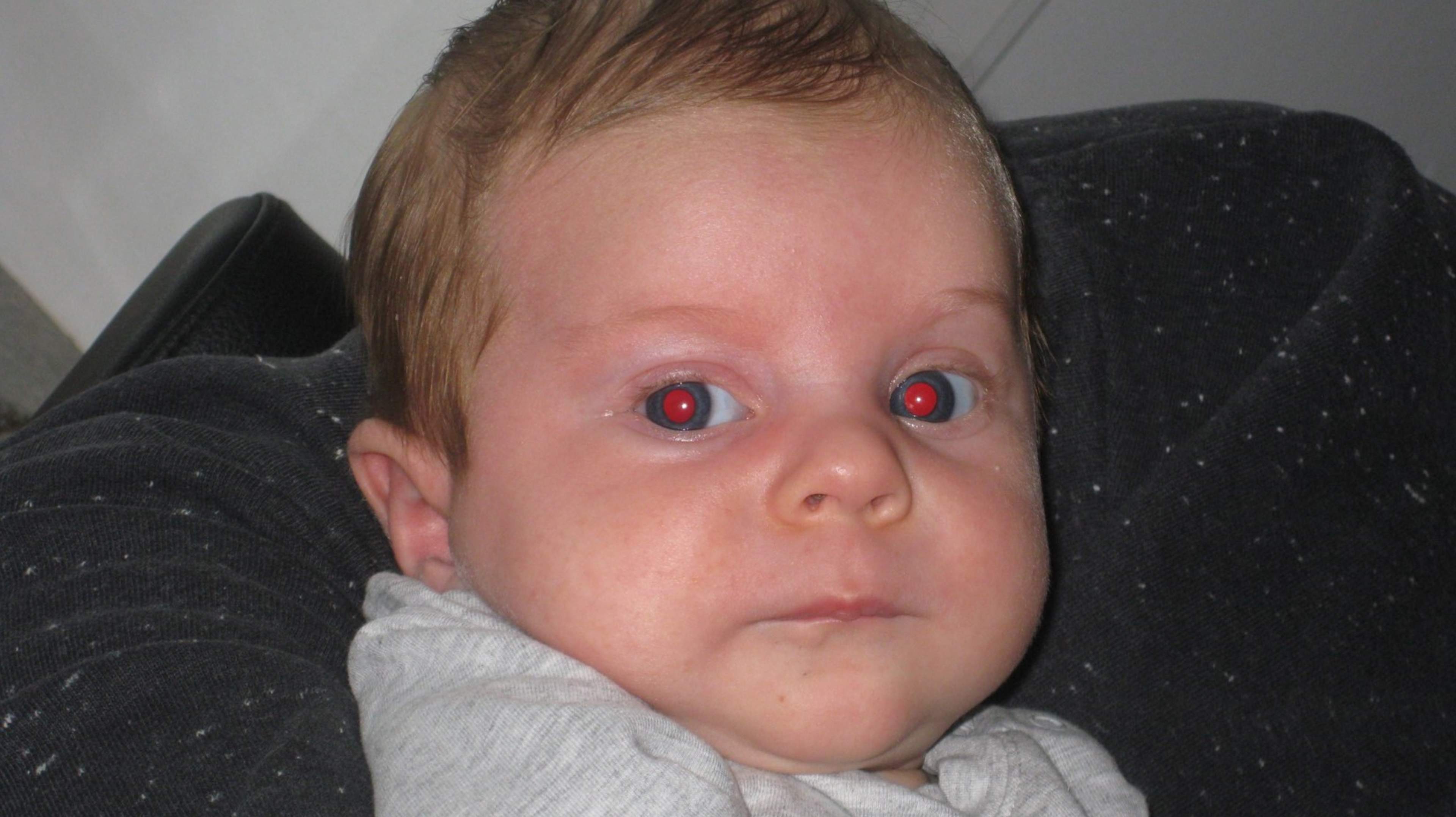 Vaaleaihoisen lapsen oranssinpunainen punaheijaste silmistä.
