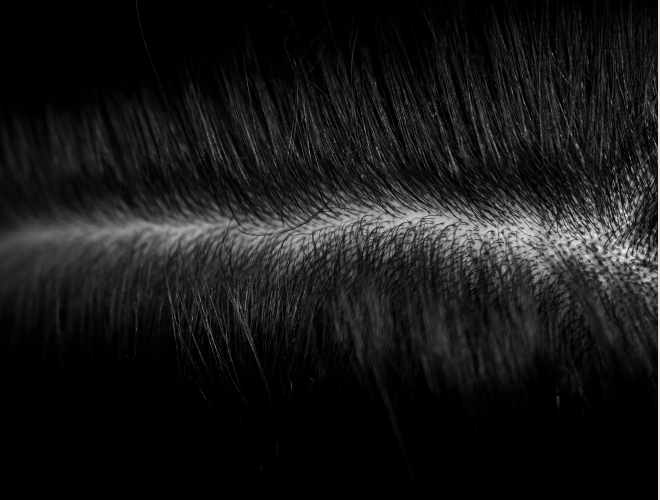 Skæl, tør hud og kløe? Slip af med hovedbundsproblemer