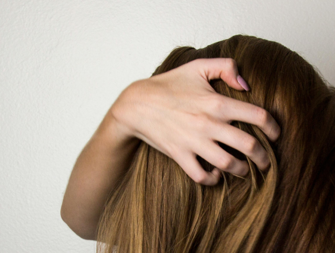 Farmakonomen guider - slip af med skæl i hovedbunden