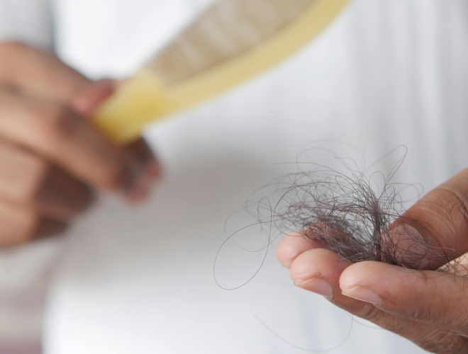 Hårtab og hårudtynding - årsager og behandling