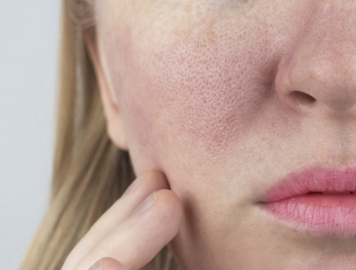 Sensitiv hud i ansigtet – guide til daglig pleje