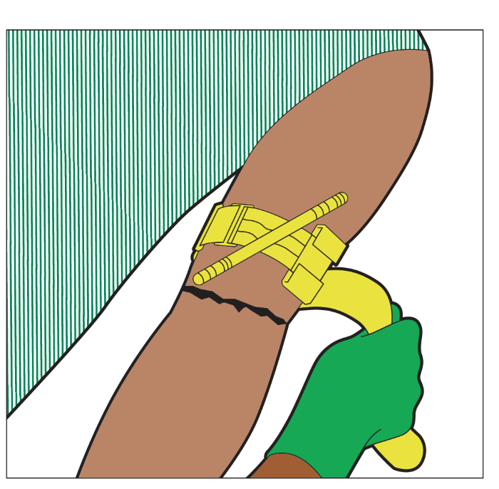 Illustration of an arm with a tourniquet and someone pulling the strap.