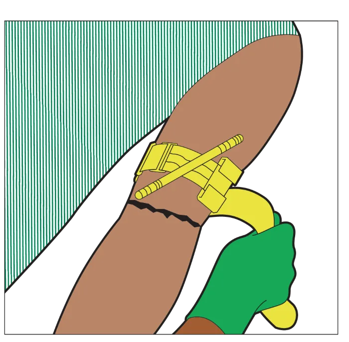 Illustration of an arm with a tourniquet and someone pulling the strap.