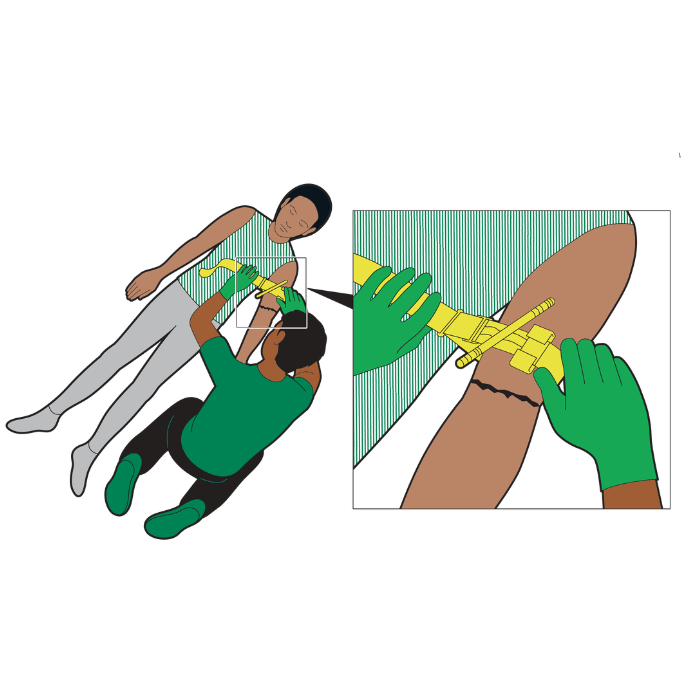 Illustration of someone putting a tourniquet onto a casualty's arm. 