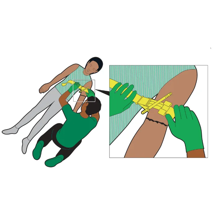 Illustration of someone putting a tourniquet onto a casualty's arm.