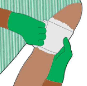 An illustration depicting someone applying haemostatic dressing.