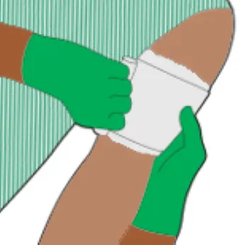 An illustration depicting someone applying haemostatic dressing.