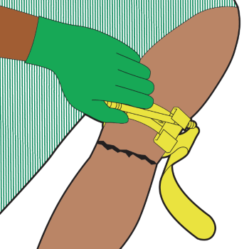 Illustration of someone tightening the rod of a tourniquet attached to a person's arm.