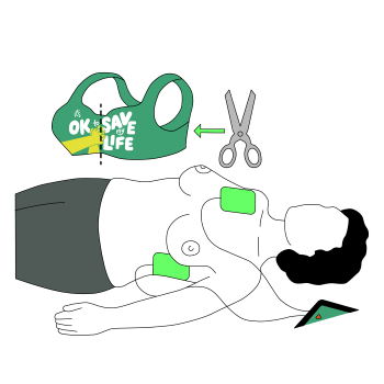 An illustration showing to remove a top before using a defibrillator and the pad placement on an adult.