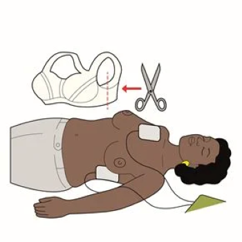 An illustration showing to remove a top before using a defibrillator and the pad placement on an adult.