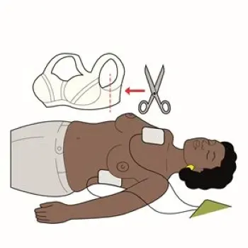 An illustration showing to remove a top before using a defibrillator and the pad placement on an adult.