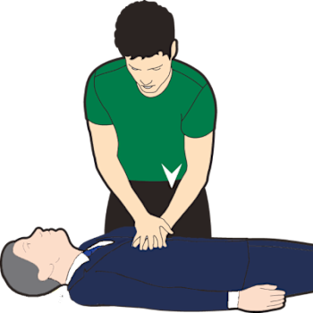 An illustration depicting CPR chest compressions.