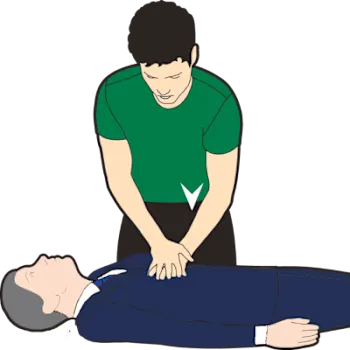 An illustration depicting CPR chest compressions.