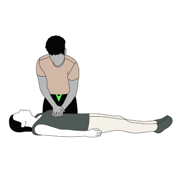 An illustration depicting CPR chest compressions.