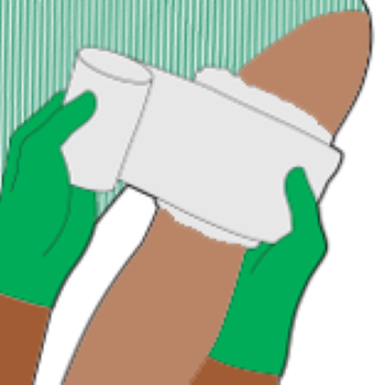 An illustration depicting someone applying haemostatic dressing.