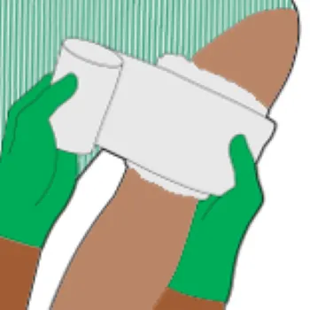 An illustration depicting someone applying haemostatic dressing.