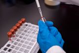 how-rwanda-is-improving-uptake-of-hpv-immunisation_asset_trust-tru-katsande-hqm5jm12ete-unsplash