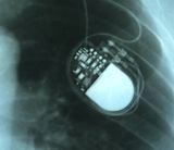 Self healing digital infrastructure