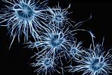 uk-launches-worlds-first-private-equity-fund-combat-dementia_asset_dementia-correct-picture