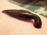 A leech feeding on human skin