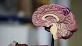 Decorative image of a brain for a solution article page