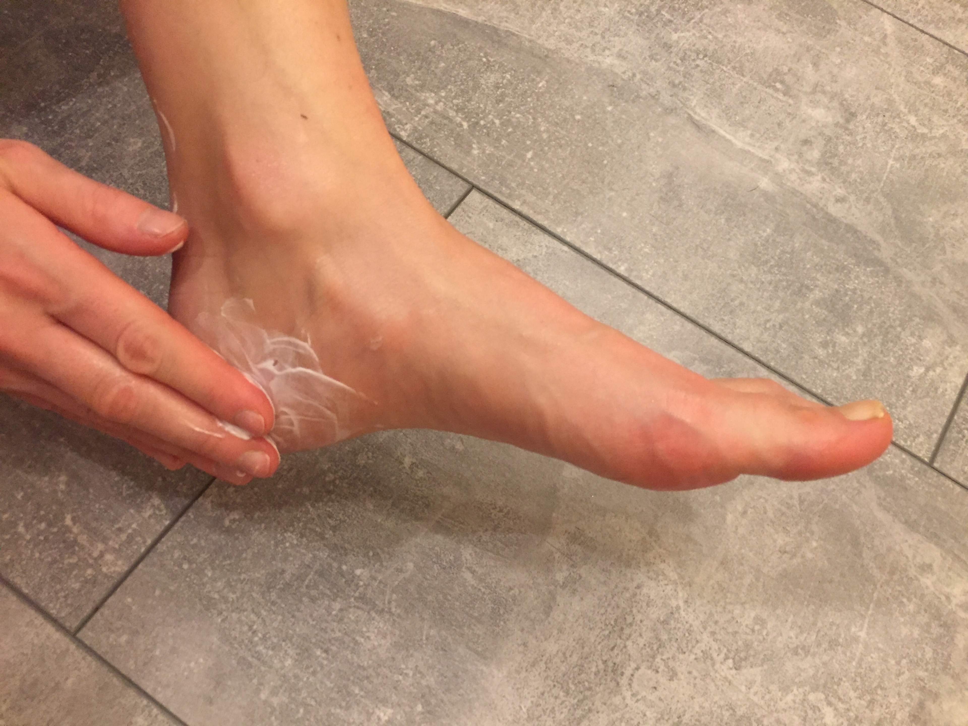 Moisturise your feet daily.