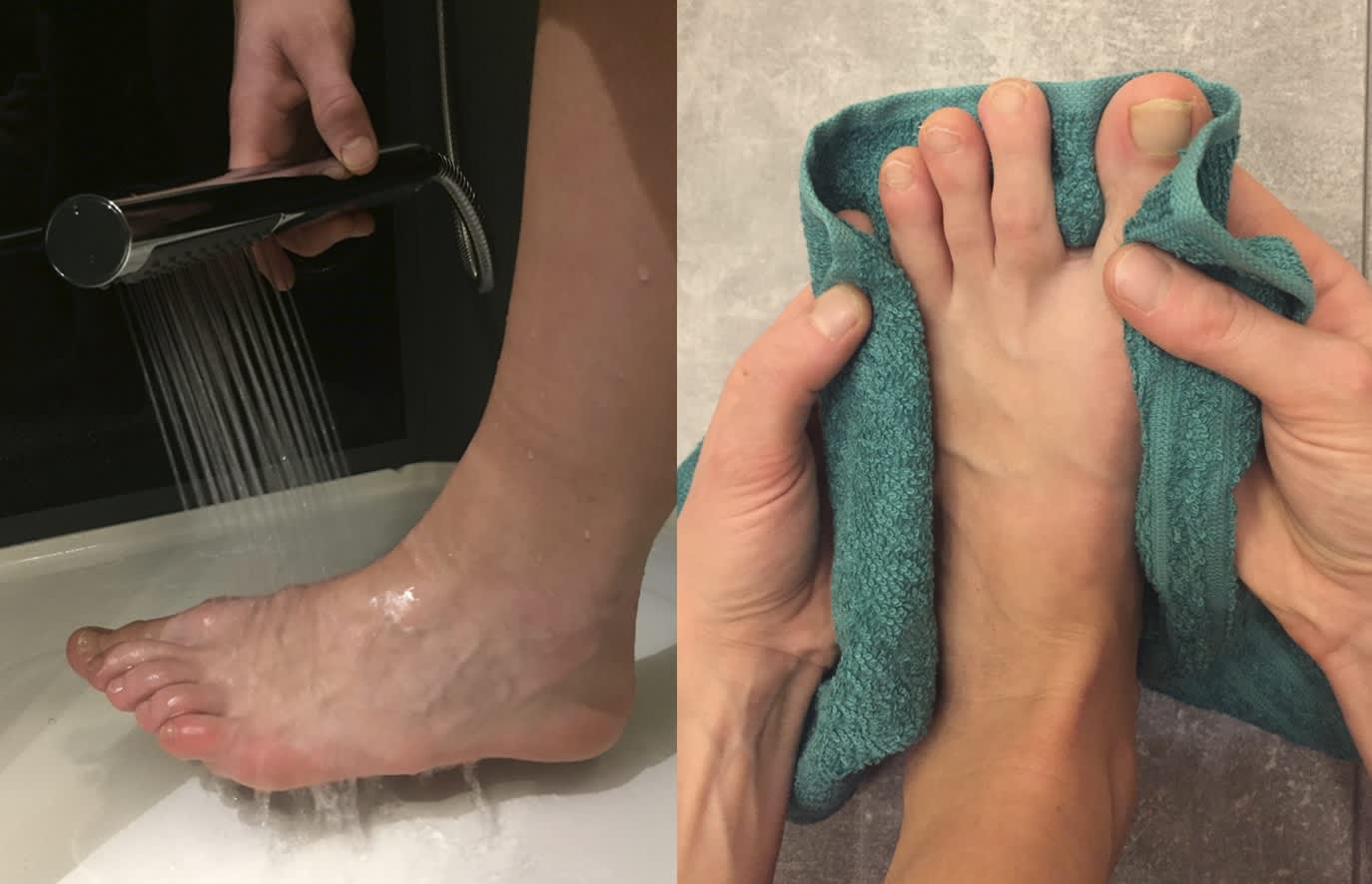 Spraya fötterna med handvarmt vatten. Torka foten och speciellt mellan tårna noggrant med en handduk.
