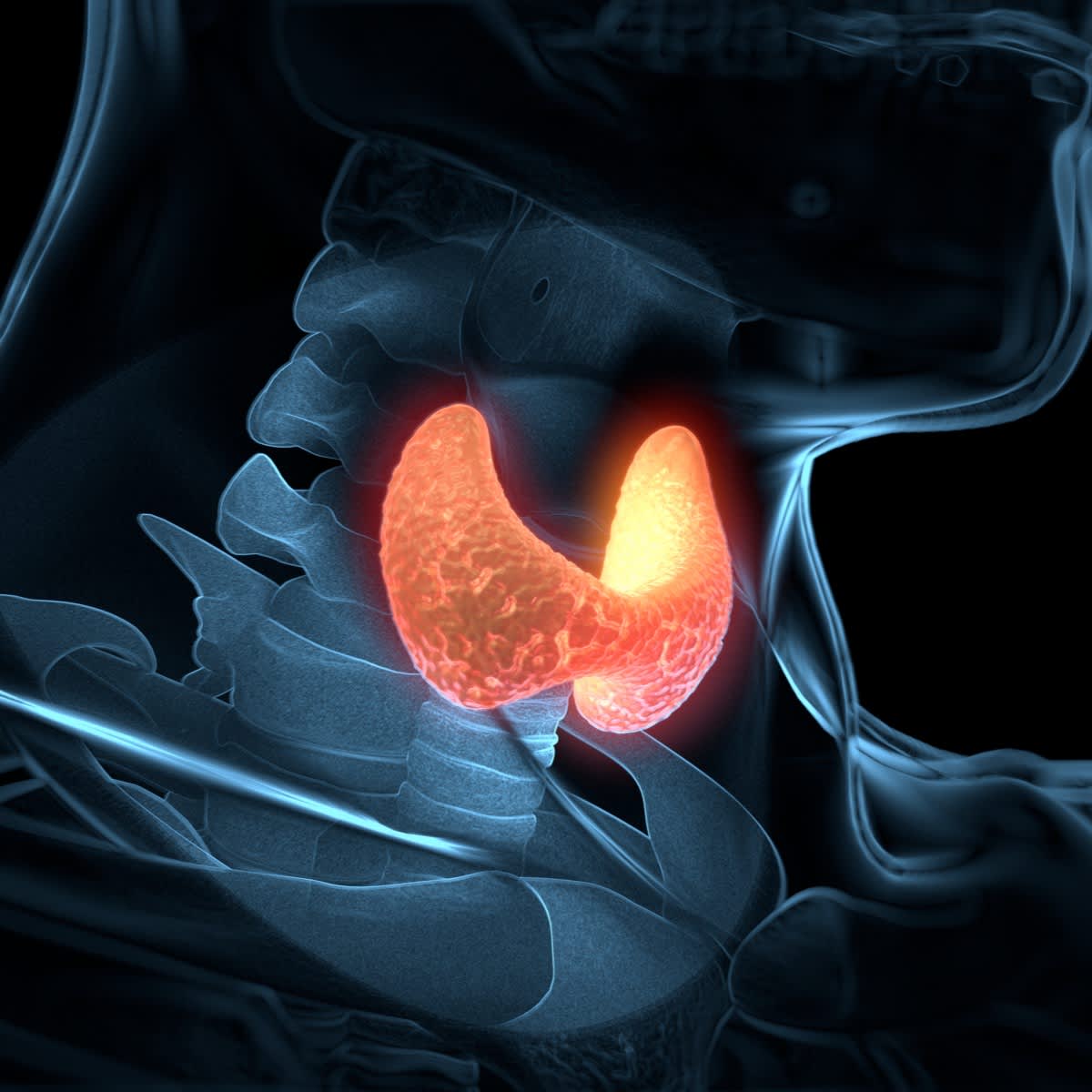 The image shows the thyroid gland, which is located in the lower part of the neck and at the front, on both sides of the trachea.