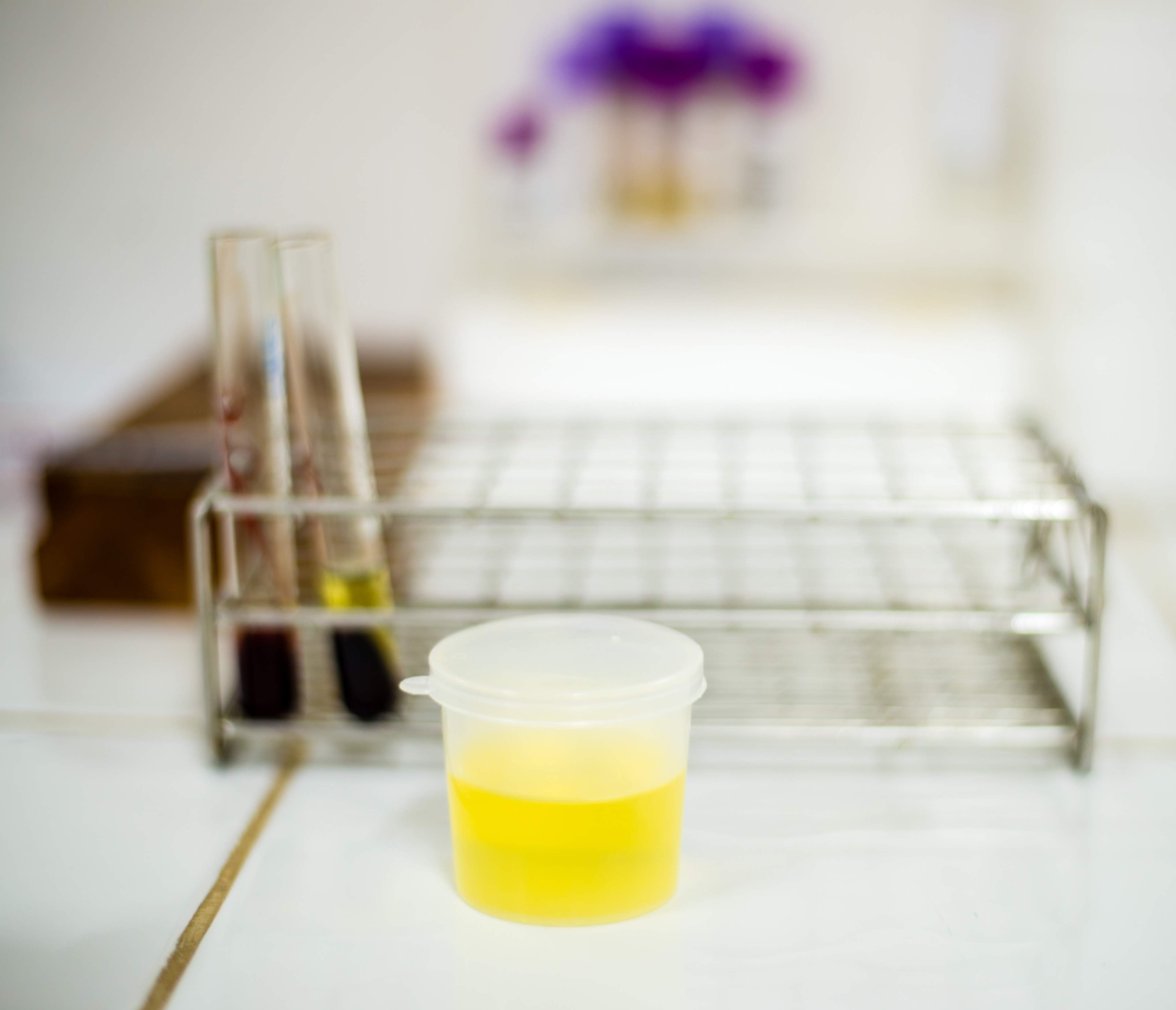 Diabetic kidney disease can be diagnosed from a urine sample.