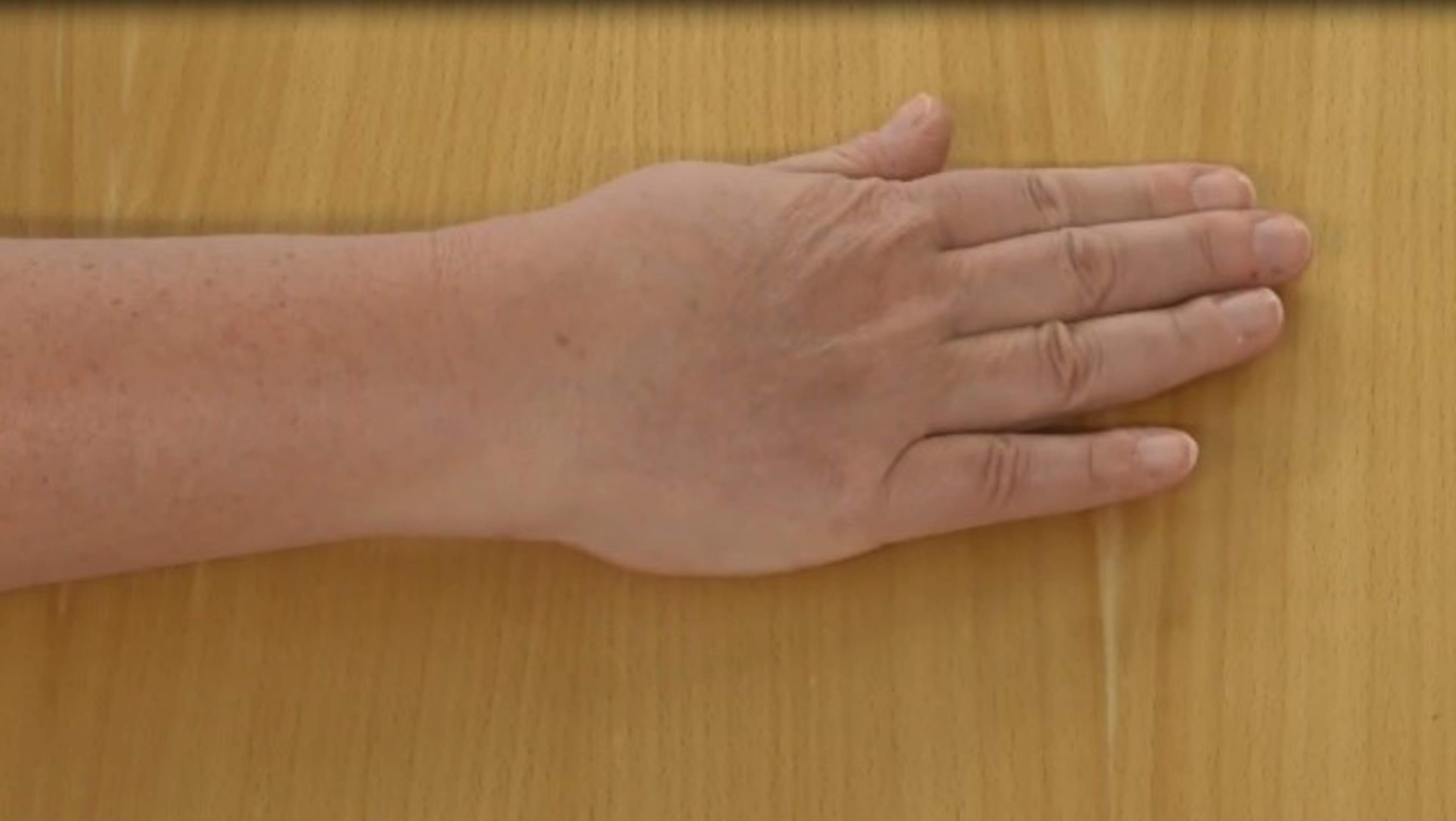 Utgångsposition för sidledsrörelse i handleden.