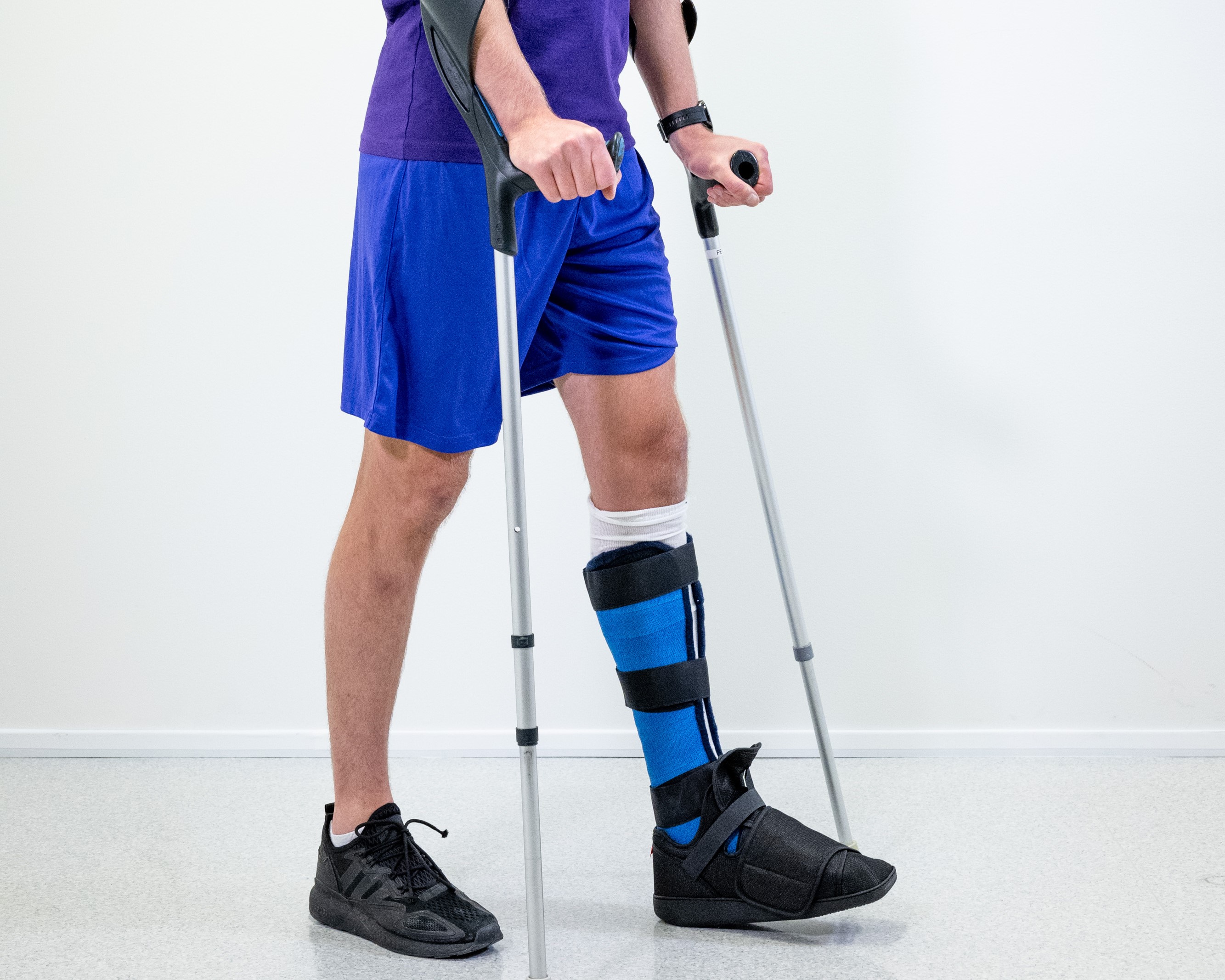 Kryckgång med det gipsade benet