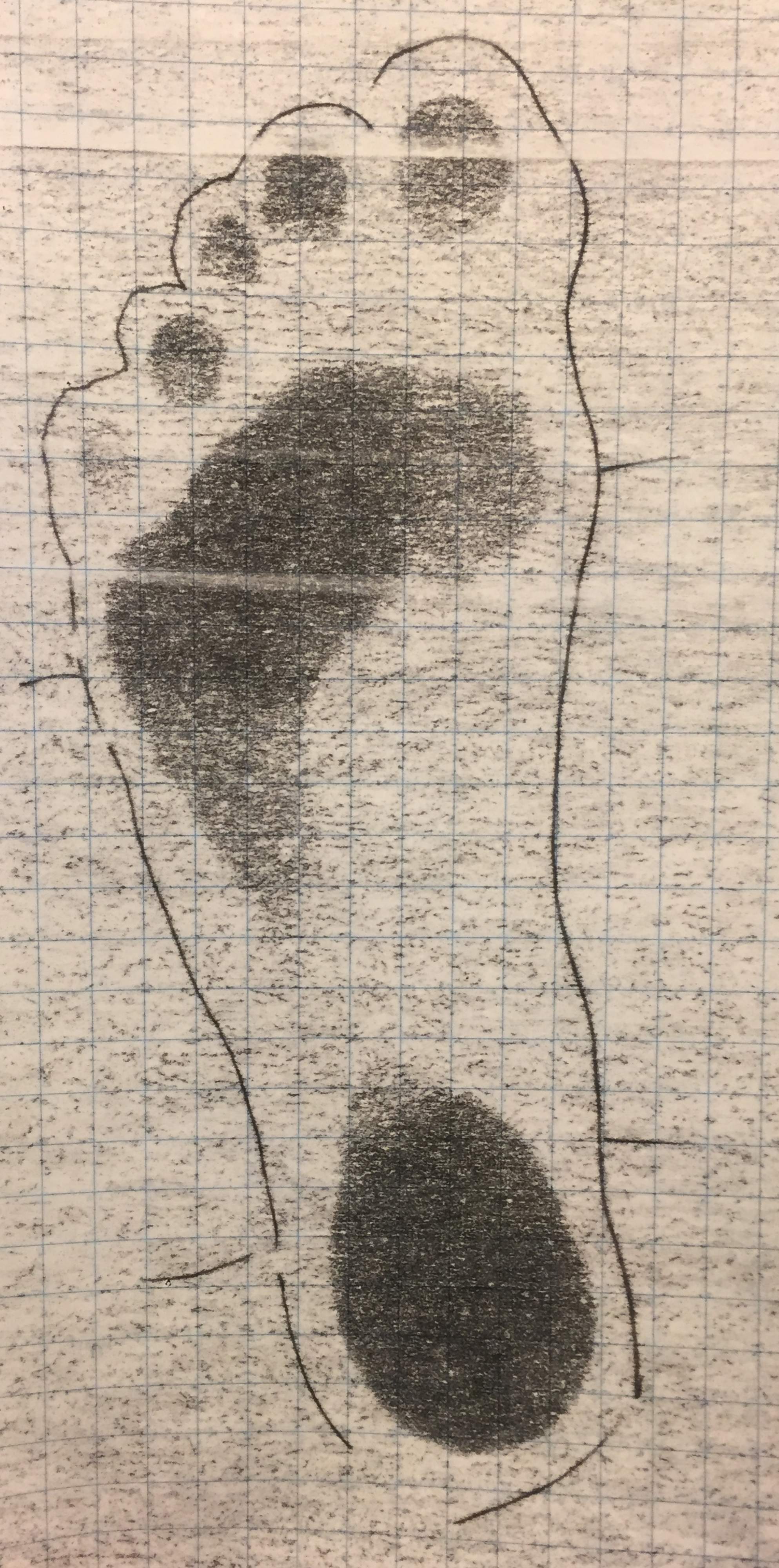 In the image is the impression pattern of a high-arched foot, where no impression is visible between the ball and the heel.
