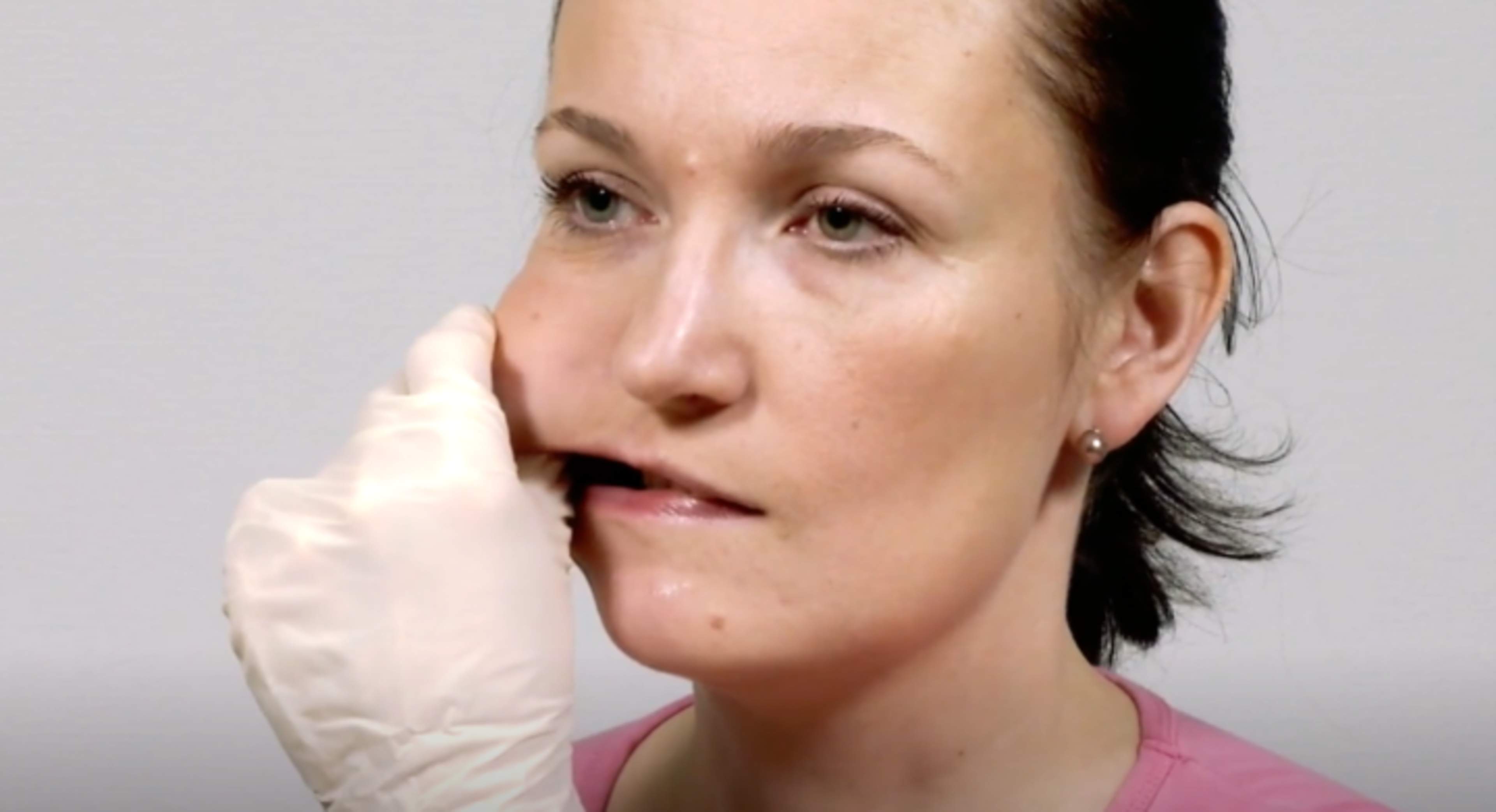 Nainen venyttää poskea ja hieroo puremalihaksia peukalo suun sisäpuolella.