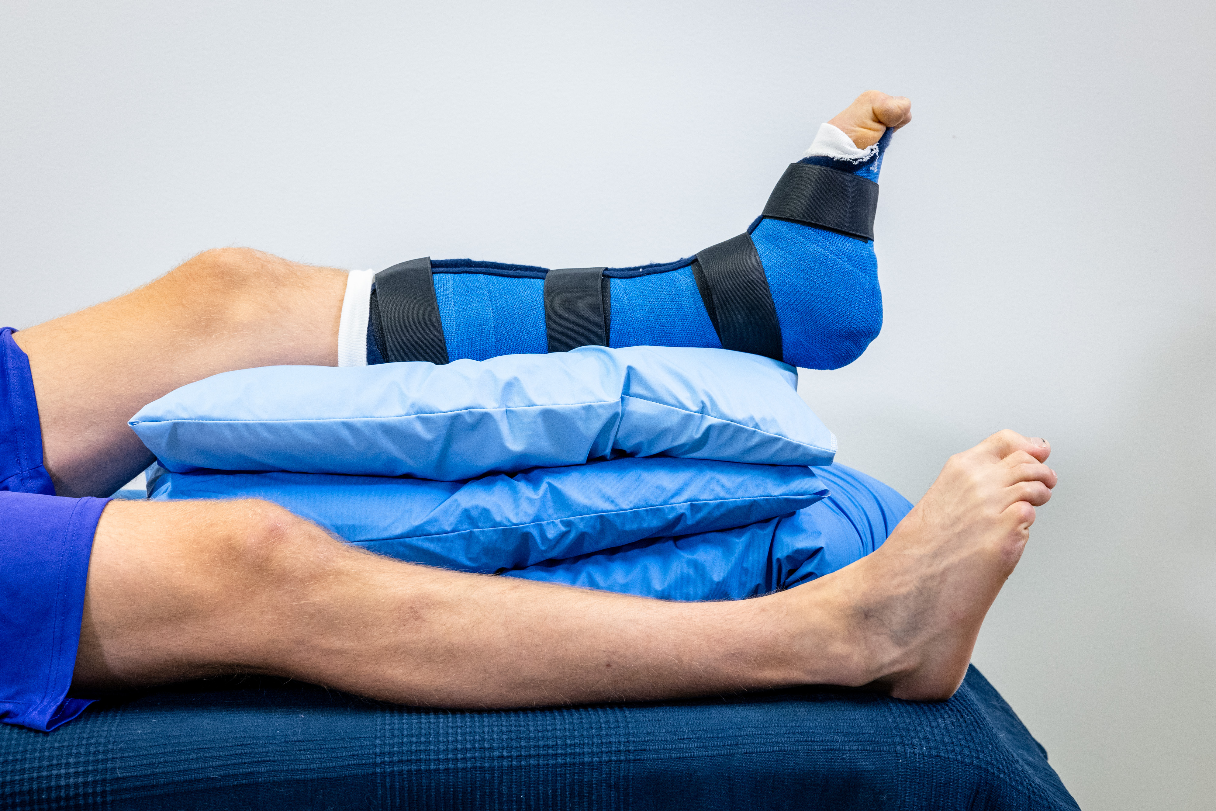 Mannen ligger på rygg i sängen med ett gips på vänster fotled och foten är lyft på kuddar. Mannen böjer sina tår.