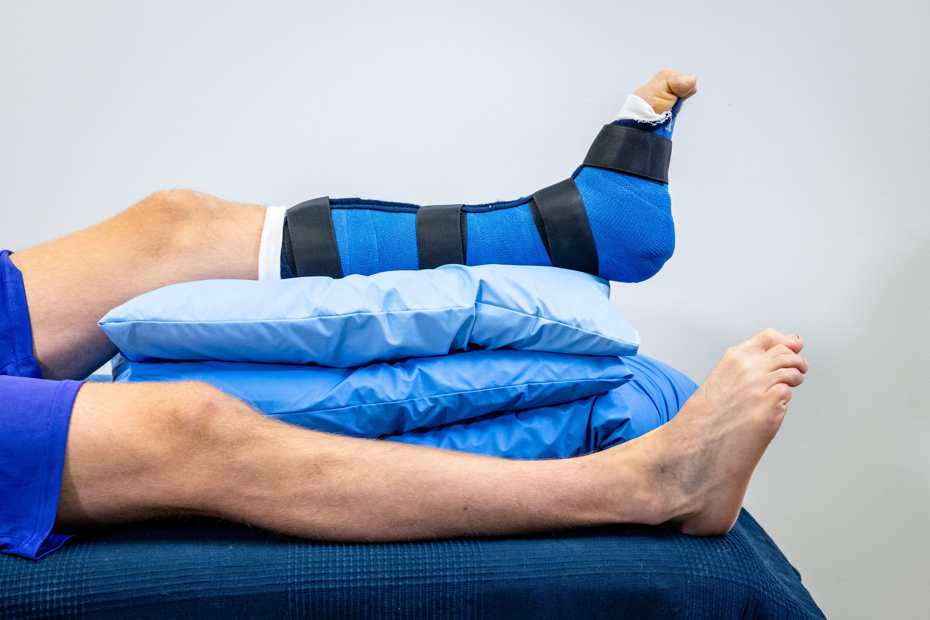 Mannen ligger på rygg i sängen med ett gips på vänster fotled och foten är lyft på kuddar. Mannen böjer sina tår.