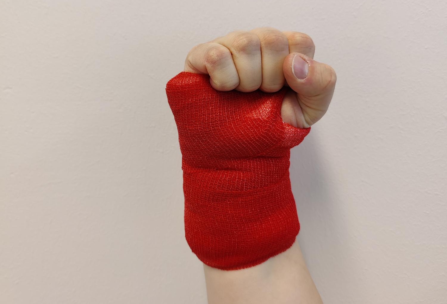 Ranteessa on leikkauksen jälkeinen sidos. Sormia koukistetaan täyteen nyrkkiin. 