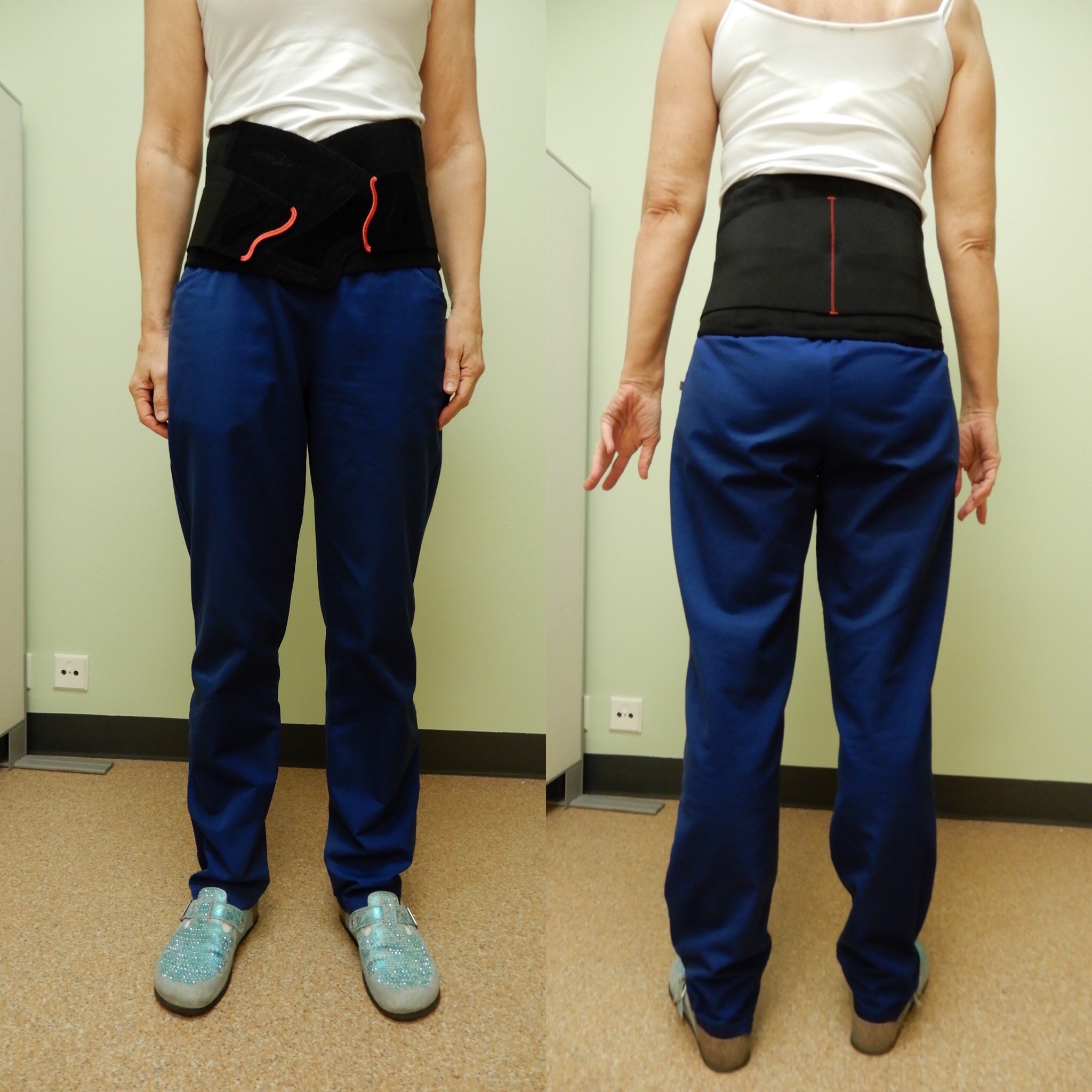 Rasitusosteopatia, spondylolyysi ja spondylolisteesi