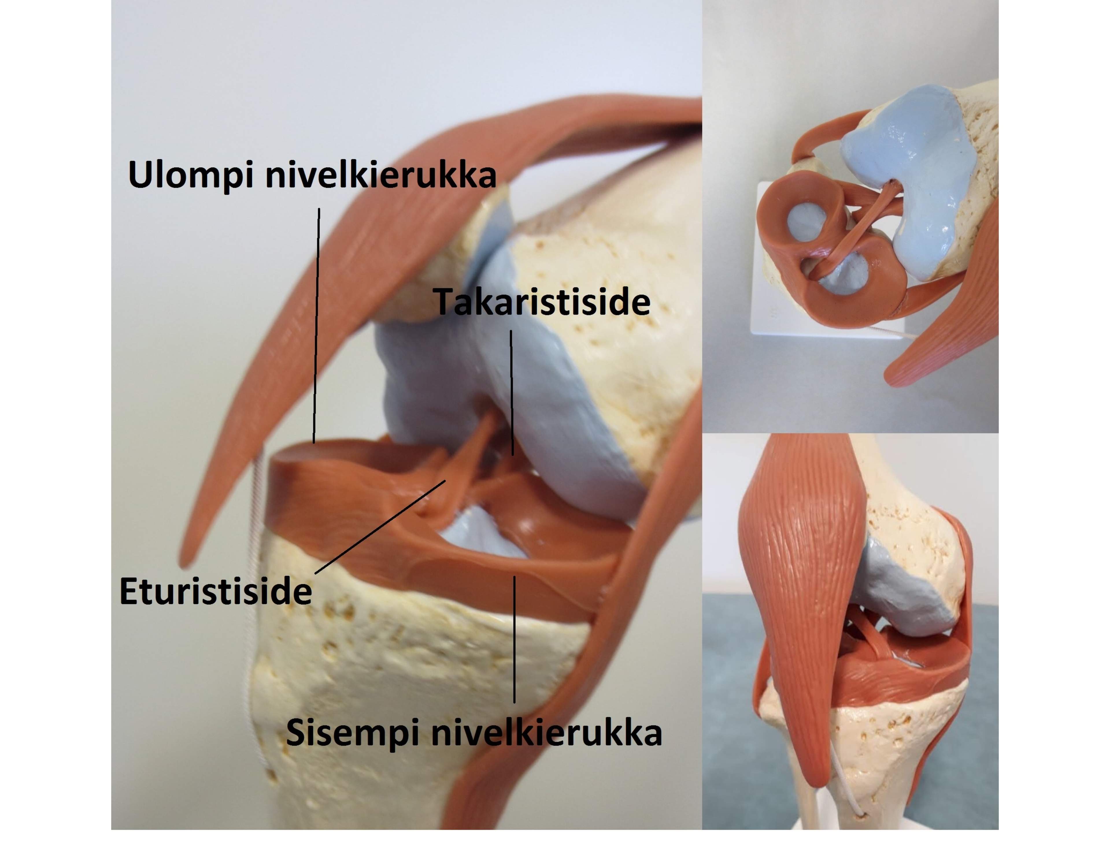 Meniskskador Och Ledbandsskador I Kn t meniskskador-och-ledbandsskador-i-kn-t