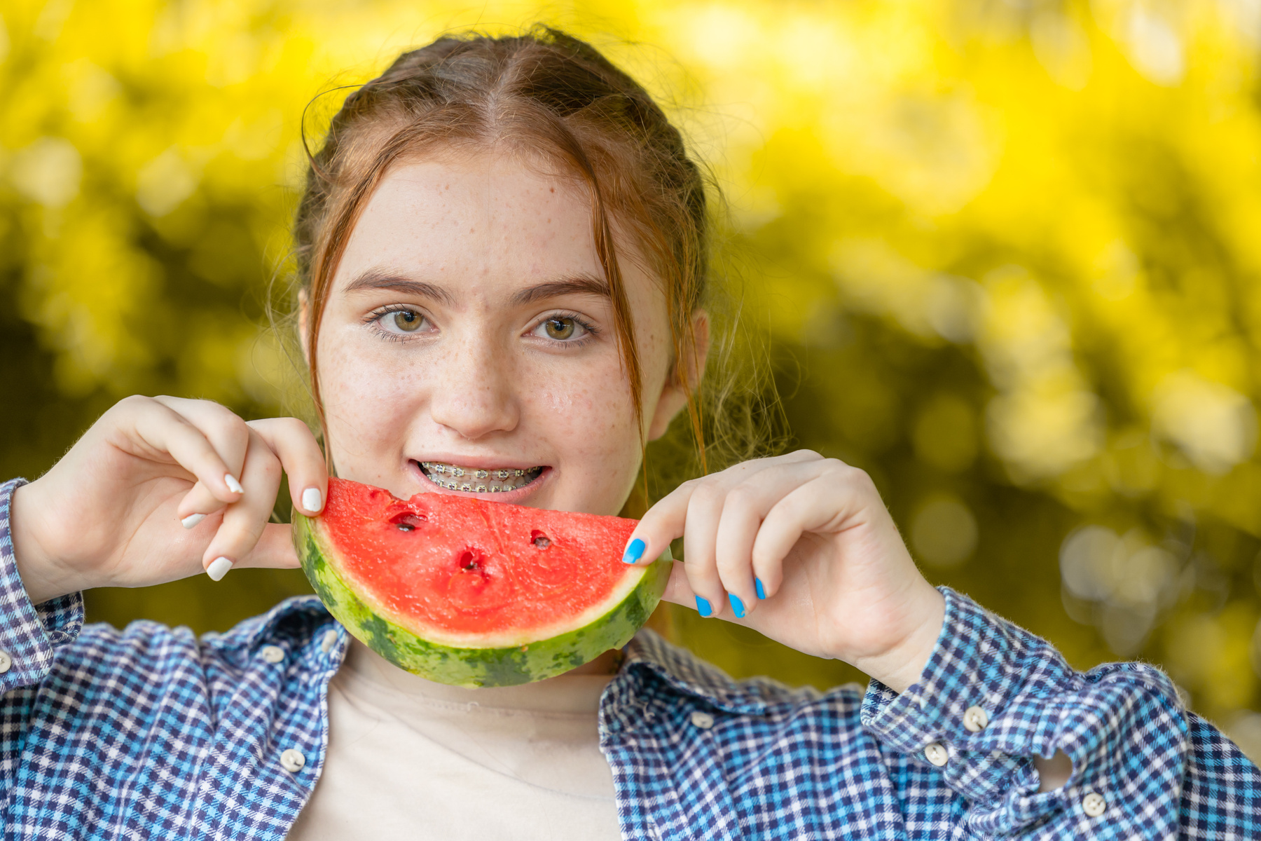 Nuori tyttö hymyilee ja pitelee vesimelonin viipaletta. Suussa näkyvät hammasraudat.