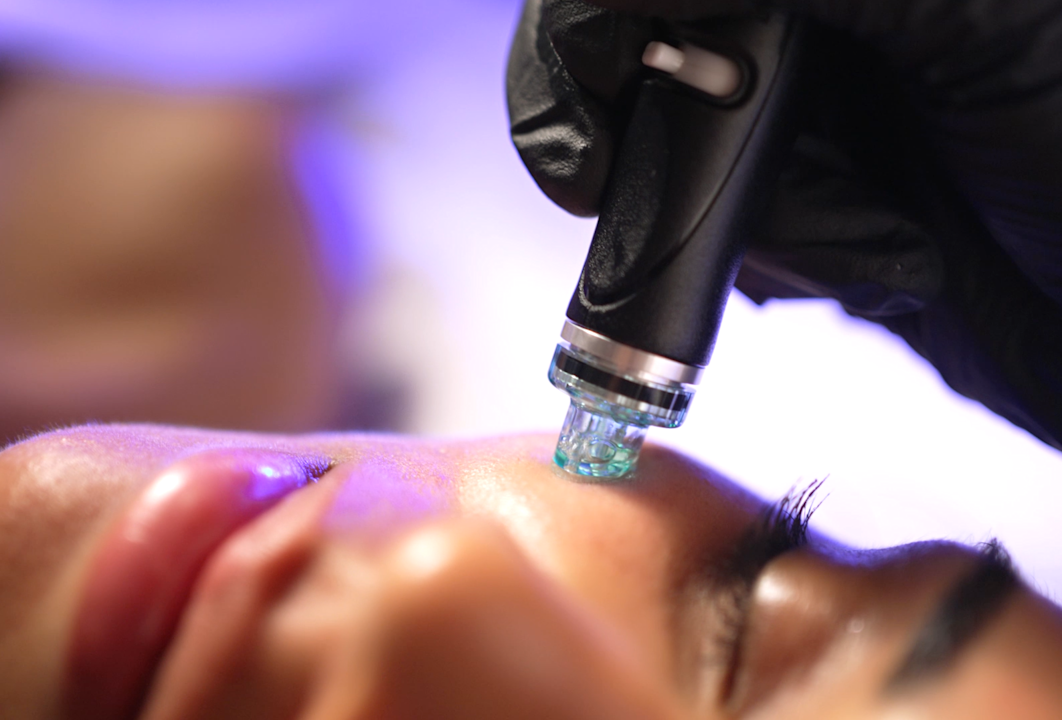 ERO - Wellness - Eden Spa - Facial