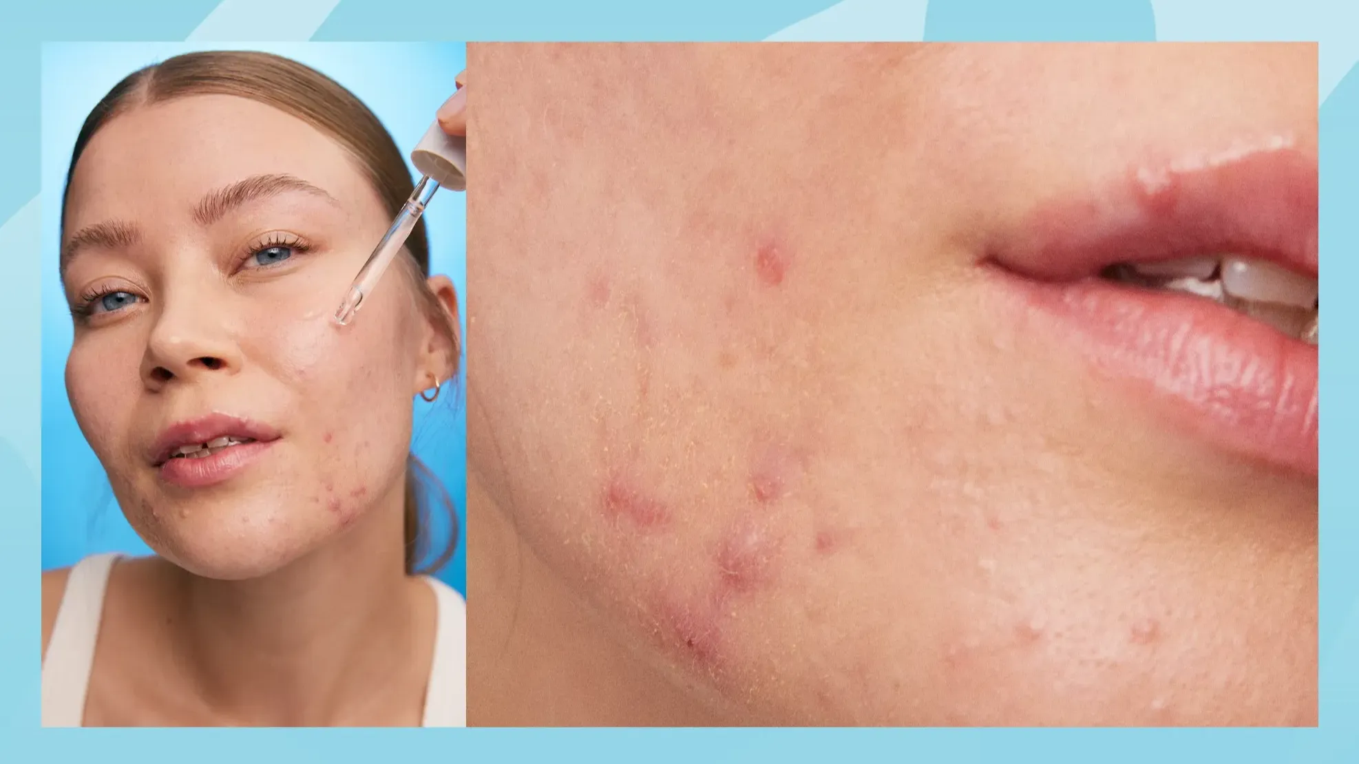 Ular ozlarining cuckold jinsiy aloqa videosini suratga olishdi.