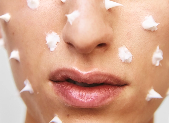 Närbild av ansikte med små klickar vit ansiktskräm jämnt applicerade över kinder och runt munnen. Fokus på hudvård och återfuktande ansiktskräm inför insmörjning.